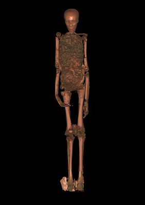 CT scan of Tut's mummy. From Hawass press release